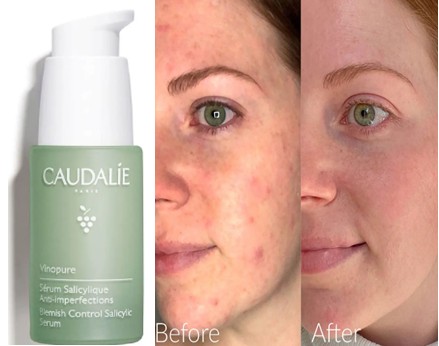 Caudalie Vinopure Blemish Control Salicylic Serum 欧缇丽淡斑控制水杨酸精华液30毫升