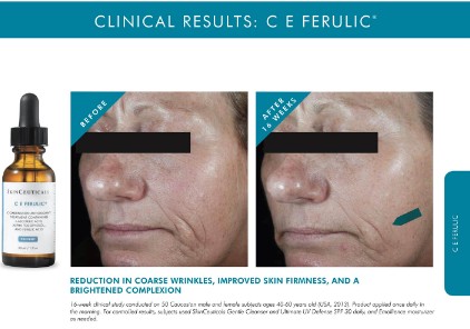 Skinceuticals Vitamin C 维他命C系列产品详情