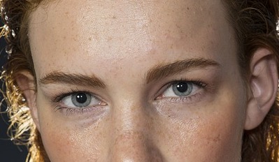 无斑护肤：用成熟的技术清除老年斑